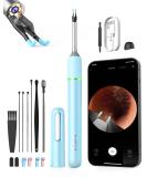 Ear Wax Removal Tool with Camera - Bebird Note 5 Ear Cleaner | Visual Earwax Cleaning Kit with Otoscope, Light, Pick & Tweezers - 3 in 1 WiFi Ear Scope for Ear Picking (Light Blue) - Buy Online on GoSupps.com