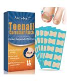60 Pcs Toenail Correction Patch | Ingrown Toenail Treatment & Repair Stickers | Pain Relief & Easy Application - Buy Online on GoSupps.com