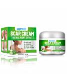 Natural Aloe Vera Scar Cream 20g Helps Soothe Acne Scars C-Section Scars Burns And Surgery Scars Works On Both Old And New Scars - Buy Online on GoSupps.com