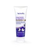 TriDerma Cracked & Crusty  Healthy Foot Cream Moisturizes  Softens and Heals Dry Feet  Cracked Heels and Dry Elbows with Salicylic Acid  Urea  Shea Butter  AP4 Aloe and Vitamins  4.2 Ounces - Buy Online on GoSupps.com