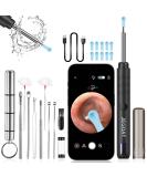 High-Definition Ear Wax Removal Tool Kit | 1296P Camera & 9 Picks | iOS & Android Compatible - Buy Online on GoSupps.com