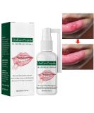 Mouth Ulcer Treatment Spray Mouth Ulcer Treatment for Adults Canker Sore Treatment Oral Care Spray Herbal Mouth Spray Canker Sores Relief Spray for Mouth Ulcer Bad Breath Treatment Mouth Freshener - Buy Online on GoSupps.com