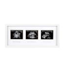 Pearhead Trimester Progression Sonogram Picture Frame - Gender-Neutral Pregnancy Milestone Keepsake for Baby Nursery D cor - Ideal Mother's Day Gift - Buy Online on GoSupps.com