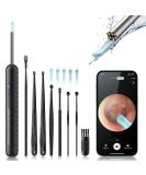 Ear Wax Removal Tool Kit with 8 Ear Sets and Otoscope for iPhone and Android Phones (Black) - Buy Online on GoSupps.com
