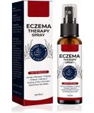 Eczema Therapy Spray Natural Eczema Relief Spray Eczema Treatment Fast Acting Itch Relief (1Pcs) - Buy Online on GoSupps.com