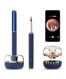 BEBIRD Note3 Pro Max Ultimate 10MP HD Ear Wax Removal Camera Tool with 25-Piece Tweezer and Rod - Bebird Ear Cleaner for iPhone Android (Blue) - Buy Online on GoSupps.com