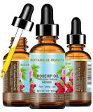Pure Rosehip Oil 4 Fl. oz - Natural Anti-Aging Moisturizer for Face Body Hair & Nails | Botanical Beauty - Buy Online on GoSupps.com