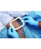 3M Tegaderm Transparent Film Dressing 2.375 x 2.75 - Box of 100 | Picture Frame Style - Buy Online on GoSupps.com