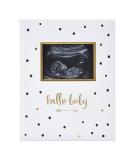 Pearhead First 5 Years Baby Memory Book - Gender-Neutral Baby Keepsake - Black and Gold Polka Dot Design - Perfect Gift for New Parents - Includes Hello Baby Sonogram Book - 1 Count - Buy Online on GoSupps.com
