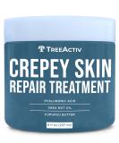 TreeActiv Crepey Skin Repair Treatment - Firming Cream with Hyaluronic Acid for Face & Neck | 8 fl oz | Moisturizing Lotion for Dry Crepey Skin - Buy Online on GoSupps.com
