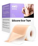 AWD Medical Silicone Scar Sheets - Silicone Gel Sheets for Scar Removal, Silicone Sheets For Removing Scars Painlessly, Reusable Silicone Scar Tape, Custom Size Strips For Scars 1.6” x 60” Roll 1.6x60 Inch (Pack of 1) - Buy Online on GoSupps.com