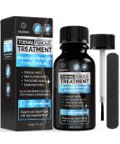 Extra Strength Toenail Fungus Treatment 30ML - Fast Relief for Men & Women | Nail Fungus Cure - Buy Online on GoSupps.com