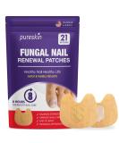 Extra Strength Toenail Fungus Treatment Patches | 21 Effective Overnight Nail Repair Patches - Buy Online on GoSupps.com