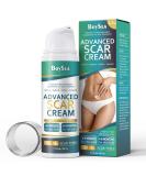 Buy Advanced Scar Cream - 1.76 oz | Effective Treatment for Keloids C-Section Surgery Burns & Acne | Fast Fading for Old/New Scars - International Shipping Available - Buy Online on GoSupps.com