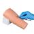 Ultrassist Intradermal Injection Practice Simulator  Intradermal Injection Training Trainer for Nursing Students  Medical Education
