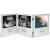 VonHaus Baby Scan Photo Frame Multi-Photo Picture Frame for Gender Reveal or Baby Shower Ultrasound Photo Frame Present for New Mums Double Hinged Stainless Steel Frame with 3 Photo Apertures