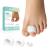 Welnove toe spreader for overlapping toes - toe spacers for bale toes - toe correction for hammer toe realignment of crooked toes (3 sizes 12 pieces) white (3 sizes)