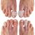 Dr Fredericks Original Gel Toe Tubes 12 Piece Variety Pack - Small, Medium and Large Sizes - Toe Protectors & Separators for Calluses - Blisters - Corns