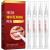 Teeth Whitening Pen 4-Pack Brighten Your Smile in Just 1 Week with Tooth Whitening Pens Fast Gentle Enamel Safe Whitening Gel for White Teeth in Mess Free Applicator Pens