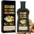 Ginger Hair Growth Shampoo Ginger Shampoo Anti hair Loss Shampoo Hair Regrowth Treatment for Men Woman Mens Shampoo Hair Growth Shampoo and Conditioner Anti Dandruff Shampoo Men