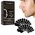Nosestripes blackheads nosestripes blackheads nose strips blackhead clear-up strips nose strips for men and women blackhead strips clearing up strips pore strips for blackheads 20 pieces new