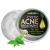 Cystic Acne Treatment and Acne Scar Remover - Made in USA - Effective Face & Body Severe Acne Cleanser with Tea Tree Oil - Prevent Future Breakouts - Natural Acne Spot Pimple Cream