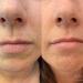 FixMySkin Vanilla Healing Lip Balm - Soothes and Repairs Dry Lips - Buy Online on GoSupps.com