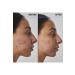 THE INKEY LIST Acne-Acne Scar Repair 1% Retinol - Face Serum 30 Ml Ko ak419 - Buy Online on GoSupps.com
