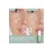 Caudalie V NOPURE SKIN BARRIER REPAIRING SALICYLIC SERUM 30 ML DEMBA4141 - Buy Online on GoSupps.com