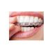 Probleach Teeth Whitening Plate - Buy Online on GoSupps.com
