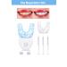 smileshop Teeth Whitening Kit