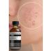 Puredermine Salicylic Acid & Dull Clogged Pores & Blackheads & Acne Serum & Niacinamide + Ha - Buy Online on GoSupps.com