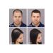 LORENTI Keratin Hair Thickener Hair Fibers Black Topic 27.5 G - Buy Online on GoSupps.com