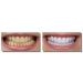 8 Large 10ml Professional 36% Teeth Whitening Gels - Optimized Formula By White Smile- 80ml by White Smile Global - Buy Online on GoSupps.com