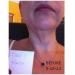 Firm Up Neck Chest & Upper Arm Firming Serum 5.7oz - Best Anti-Aging Solution for Youthful Skin | International Shipping Available - Buy Online on GoSupps.com