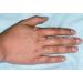 Naturasil Wart Remover - Fast-Acting All-Natural Liquid | Painless & Acid-Free | Made in USA - Buy Online on GoSupps.com