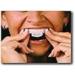 Dental Trays for Teeth Whitening - 4 Pack Thermo Gum Shield by Boolavard | International Shipping Available - Buy Online on GoSupps.com