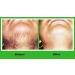 JEVR Healthier Life with Beauty Ponnatharam Hair Removal Powder (50 g) - Buy Online on GoSupps.com