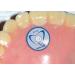 DentalMark Skin Markers - 2.0mm Non-Metallic Ball, Denture Size, 110 per Box - Buy Online on GoSupps.com