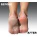 Emjoi Micro-Pedi FLEX Technology Refill Rollers - Extra Coarse - Buy Online on GoSupps.com