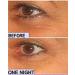 Smooth Sleepers Clear Cosmetic Strips - Flatten Wrinkles Overnight | 30 Day Supply - Buy Online on GoSupps.com