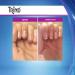 Trind Nail Repair Original: Promotes Natural Nail Growth for Damaged, Thin, and Weak Nails - Buy Online on GoSupps.com