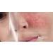 CoupeLIAC Special Skincare Gel - 20ml | Hydrating and Nourishing Formula - Buy Online on GoSupps.com