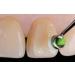 DENTAL Ivoclar Vivadent OptraSculpt Assortment Pad Resina Shaping Tool Kit - Precision Dental Sculpting Tools - Buy Online on GoSupps.com