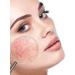 Couperose Face Serum Against Red Veins Rosacea Made in Germany 30ml - by Elaine Perine Made in Germany - Buy Online on GoSupps.com