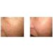Dns Derma Skin Roller For Winkles & Scars (1.0mm) - Buy Online on GoSupps.com