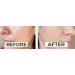 4 in 1 Facial Serum | Brightening Anti-Aging & Pigment Control | Hyaluronic Acid Niacinamide Vitamin C & E | Face Serum for All Skin Types | 1 oz - Buy Online on GoSupps.com