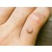 Naturasil Wart Remover - Fast-Acting All-Natural Liquid | Painless & Acid-Free | Made in USA - Buy Online on GoSupps.com