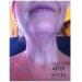 Firm Up Neck Chest & Upper Arm Firming Serum 5.7oz - Best Anti-Aging Solution for Youthful Skin | International Shipping Available - Buy Online on GoSupps.com