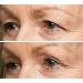 Eye Magic Original Eye Lift Kit - Small/Medium Size with Gel | Lifts Droopy Eyelids | Made in USA - Buy Online on GoSupps.com
